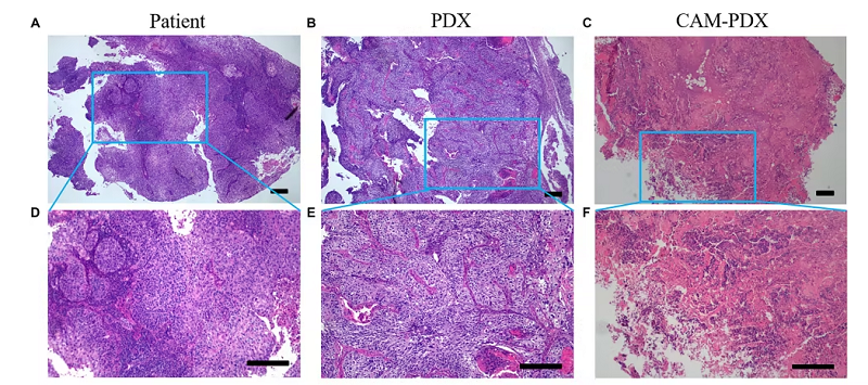 Hematoxylin-eosin (H&E) staining of patient-derived SCC, PDX, and CAM-PDX models.